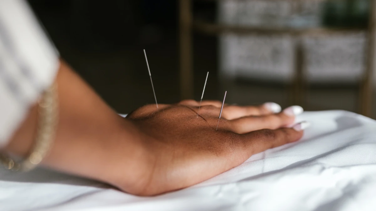 acupunctuur bij pijn nijmegen